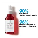 Сироватка La Roche-Posay (Ля Рош-Позе) Retinol B3 антивікова проти глибоких зморшків та нерівного тону шкіри обличчя 30 мл foto 3